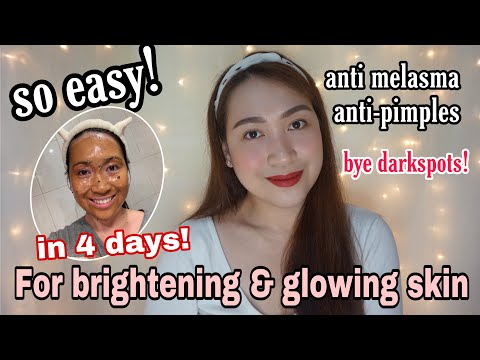 4 DAYS CHALLENGE FACE BRIGHTENING! SOLUSYON SA MELASMA PEKAS DARK SPOTS AT FRECKLES! ayaesguerra