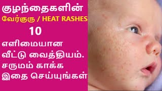 Home Remedies for BABY HEAT RASHES | Natural Methods for baby skin care | Smooth Skin