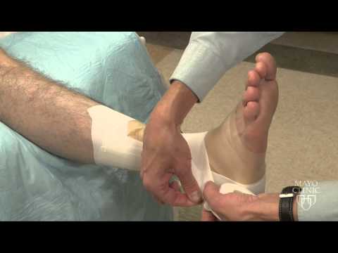Ankle Wrapping Technique - Mayo Clinic