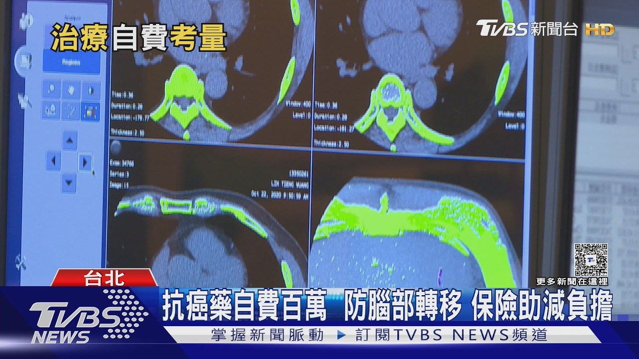癌症自費藥物該不該用？醫曝關鍵：先問自己「這些事」