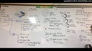 19) Dr. Wael Salah primary open angle glucoma 2