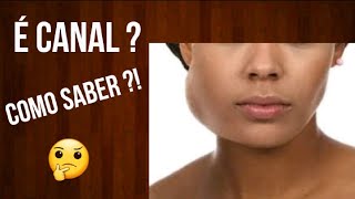 Como saber se meu dente PRECISA DE CANAL 