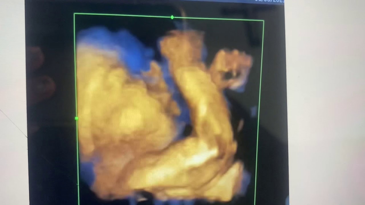 Brenda Anaid Torres Ugalde-28