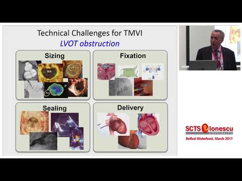 Transcatheter Mitral Valve Techniques: An Update