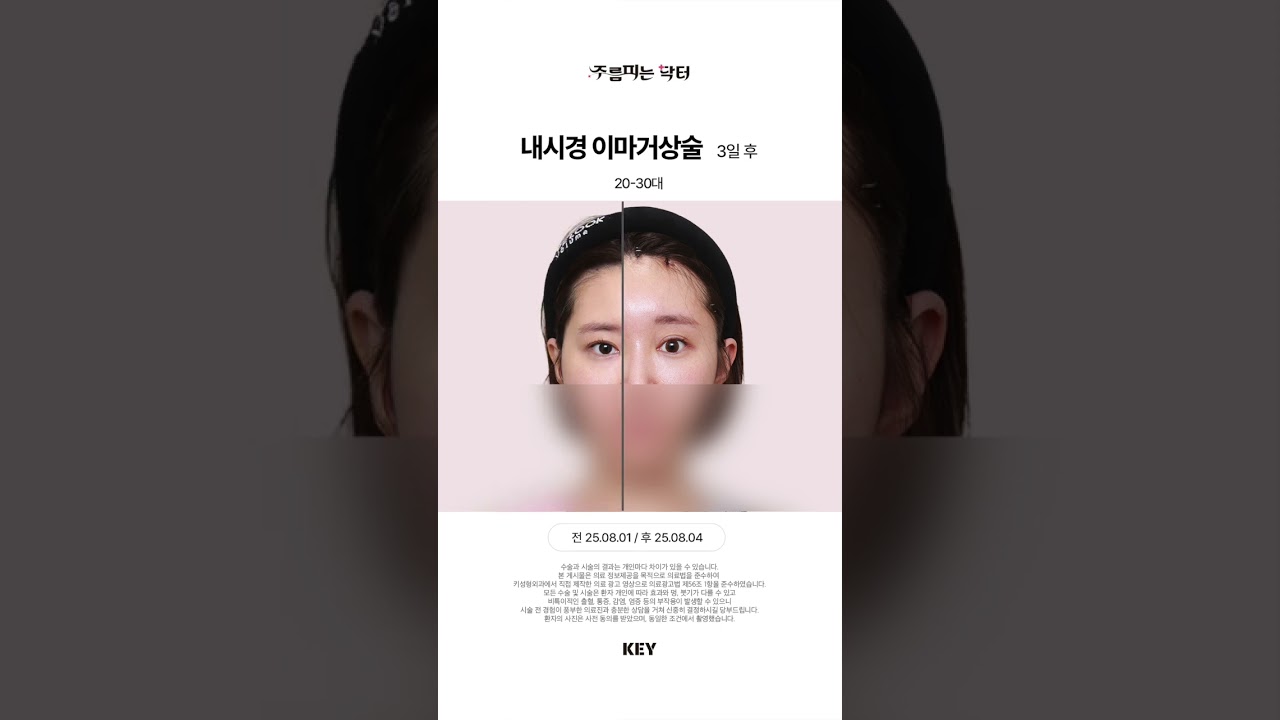 20~30대 이마거상