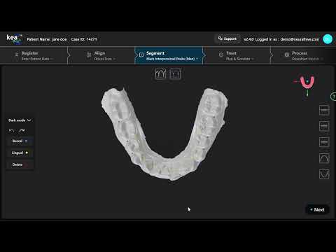 Mark Interproximal Peaks (Mandible)