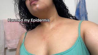 Harmed My Epidermis | Curly Cami Channel