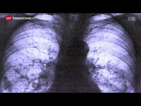 ASBEST OPFER GERICHTS-URTEIL EUROPÄISCHE GERICHTSHOF