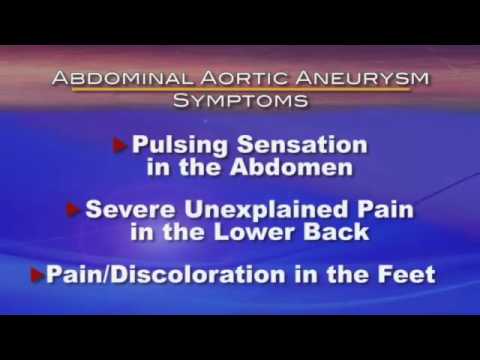 What is an abdominal aortic aneurysm