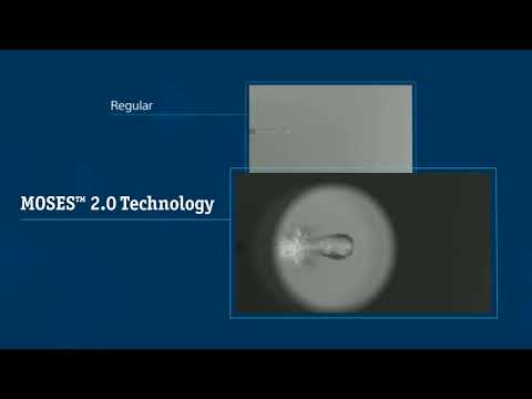 MOSES™ 2.0 Technology: Holmium Bubble for Lithotripsy