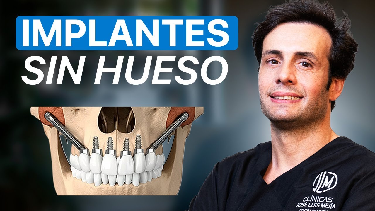 José Luis Mejía Martin-11