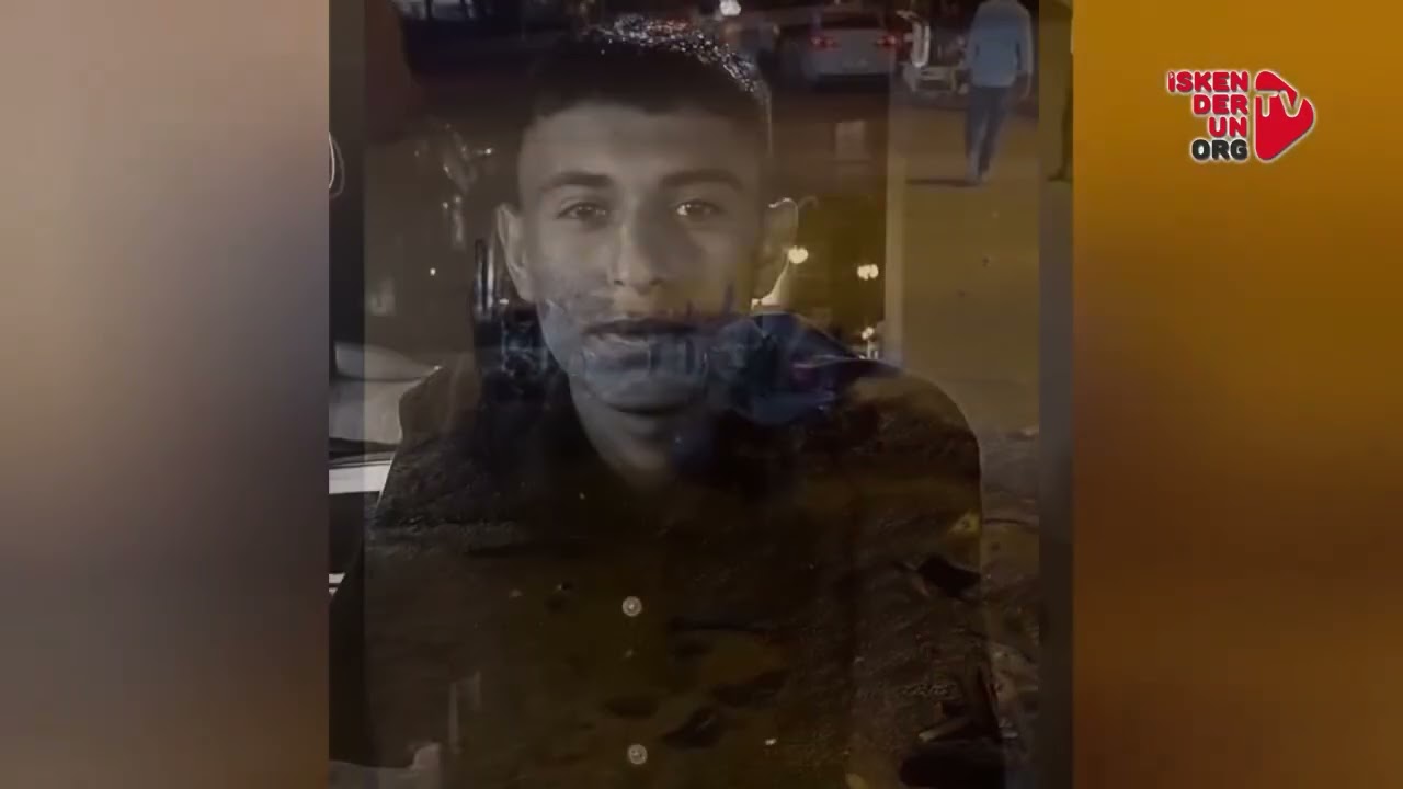 Otomobille Motosiklet Çarpıştı…