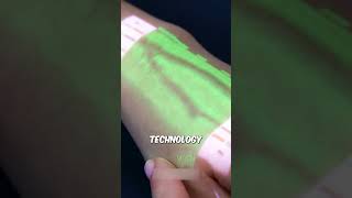 Medical Breakthrough ⚕️ #shorts