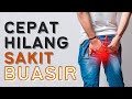 5 Cara Nak Hilangkan Buasir Cepat