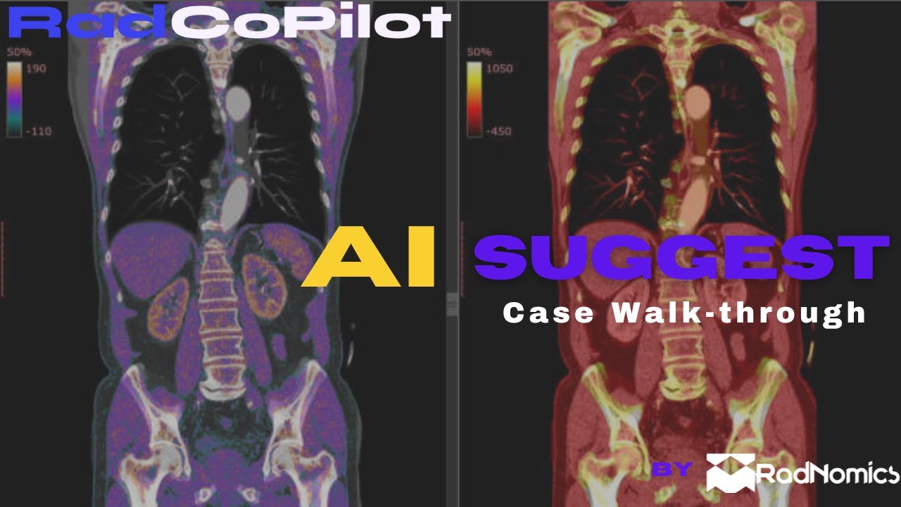 Rad AI Suggestions: Case Walkthrough for Radiology AI Software| RadCoPilot Tutorial