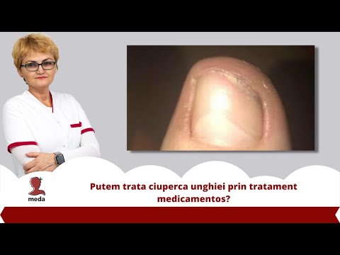unguent pentru recenzii de osteochondroză lombară