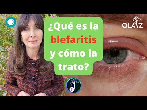 ¿Qué es la blefaritis y cómo la trato?