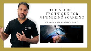 Canadian Hair Transplant Centre