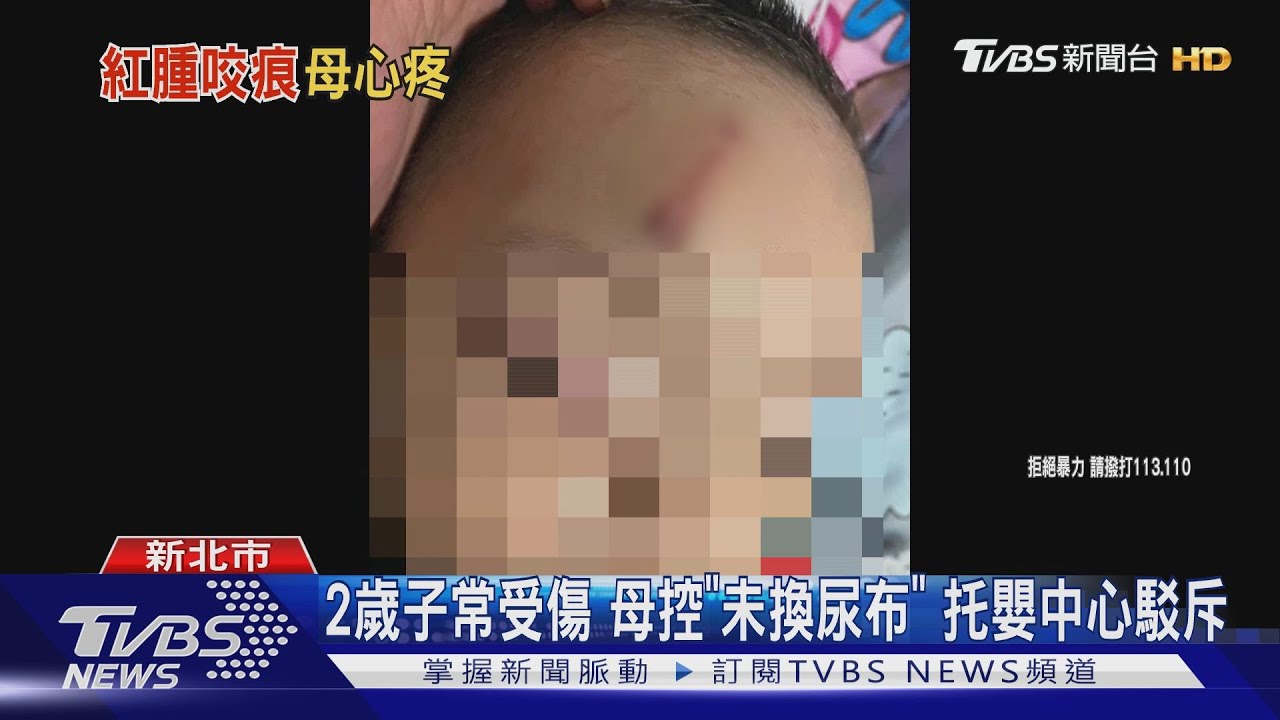 2歲子常受傷　母控「未換尿布」托嬰中心駁斥