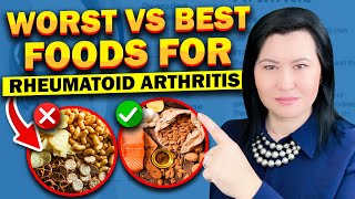 Top 10 Foods to Avoid in Rheumatoid Arthritis and 
