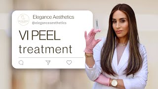 VI Peel Treatment in Pikesville & Baltimore | Elegance Aesthetics Med 