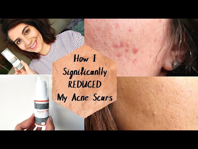 (10g) Nourisil MD Silicone Gel