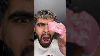 Why These Cavity Fillings DO NOT Exist Anymore! 😭🦷