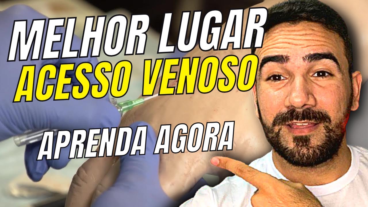 QUAL O MELHOR LUGAR PARA ACESSO VENOSO PERIFÉRICO? APRENDA AGORA