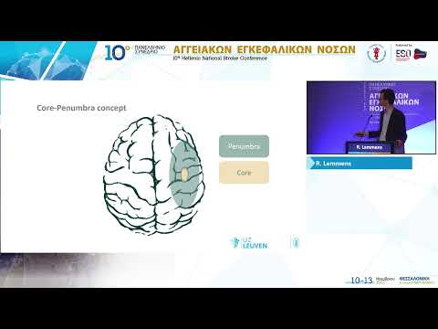 Lemmens R. - Intravenous thrombolysis in wake-up stroke and in the extended time window: practical considerations