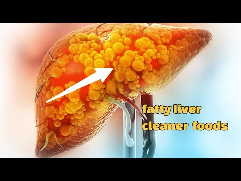 , title : 'Top 8 foods for fatty liver cleaner'