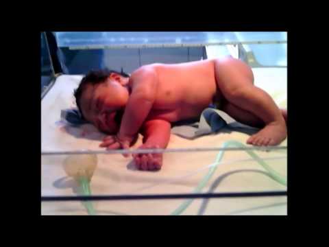 BABY CONDITION 5 MINUTES AFTER BORN ( NEW BORN ) - MIAMARA FLAMENCA