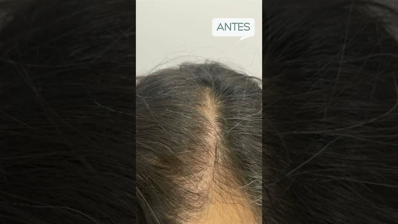 Carmen Orozco Bello-2