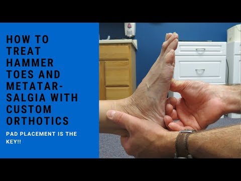 Metatarsalgia and Morton s Neuroma Evaluation and Treatment