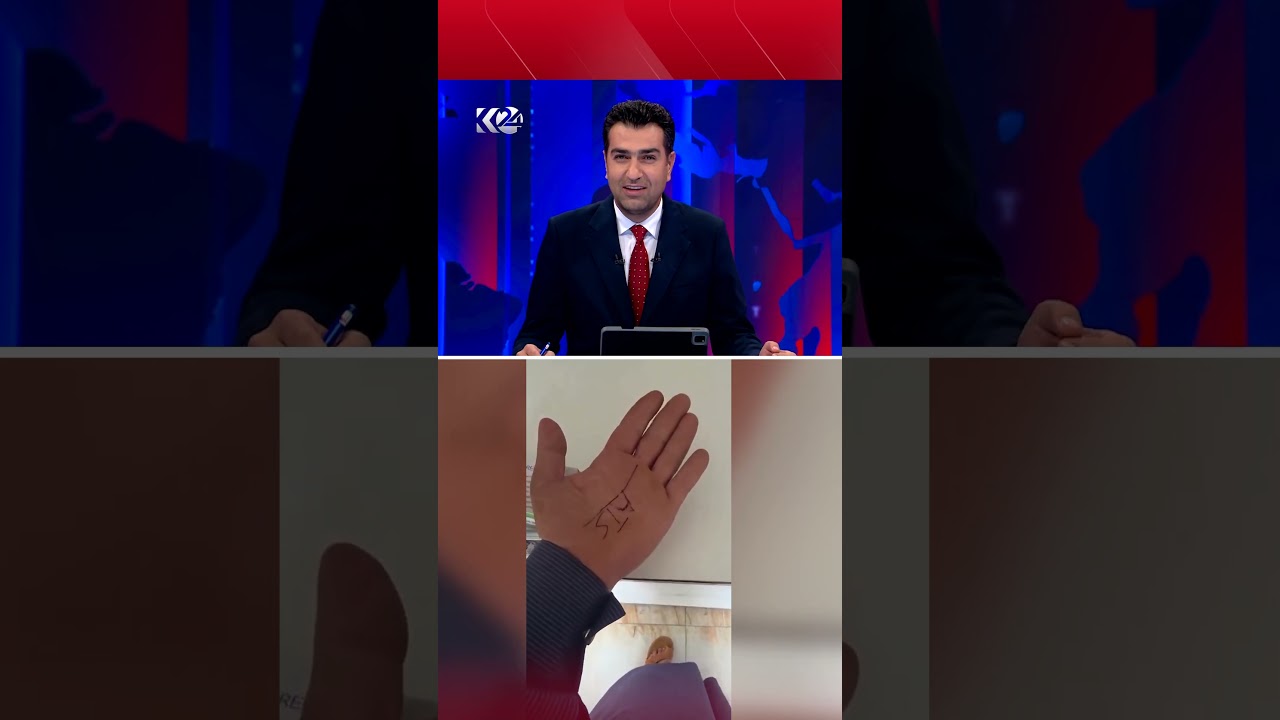 ڤیدیۆ | تەنیا لە عێراق؛ دکتۆرێک لە شوێنی رەچەتە، ناوی دەرمانی لەسەر دەستی نەخۆشەکە نووسیوە