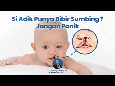 Si Adek Punya Bibir Sumbing? Jangan Panik