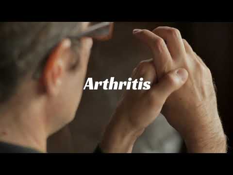 Osteoarthritis herbal medicine