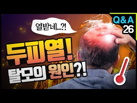 [모빈치TV] 두피열! 탈모의 원인일까?! 모발이식!!