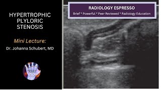 HYPERTROPHIC PLYLORIC STENOSIS: Mini Lecture, Dr. Johanna Schubert, MD