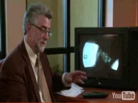 Amanda Bennet Story - Digital Motion X-Ray - DMX of Michigan