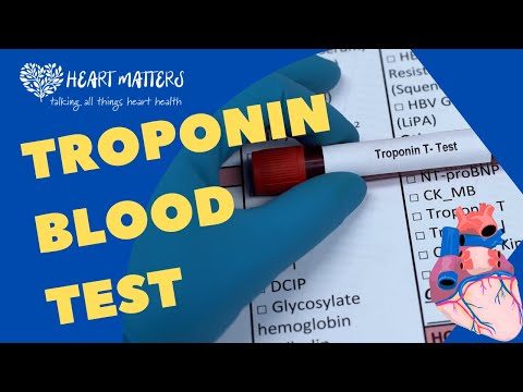 All About the Troponin Blood Test