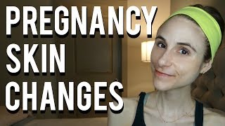 Skin changes during pregnancy| Dr Dray 👶