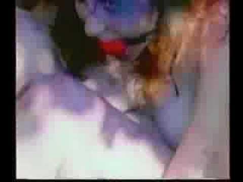 Thumbnail of the video: the Mutilation Man Trailer