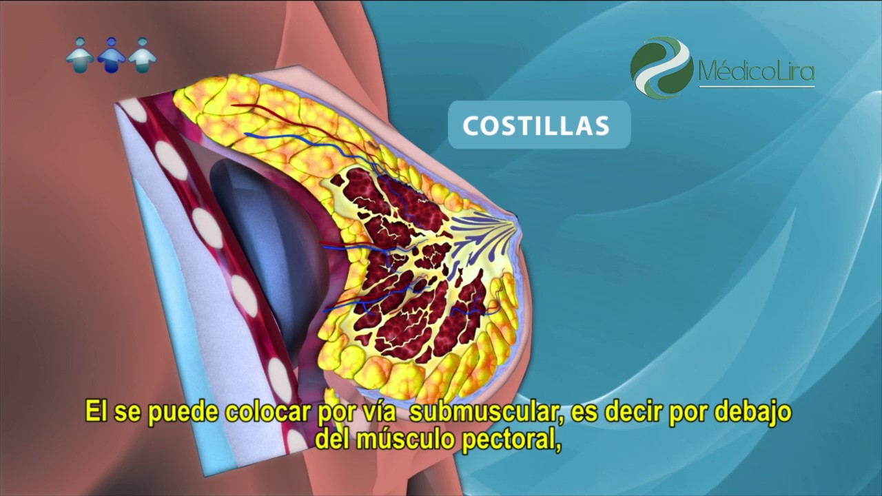 Luis Fernando Lira Menendez-21