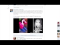 ШОК!!! Арина Тарчуткина избила свою подругу! 