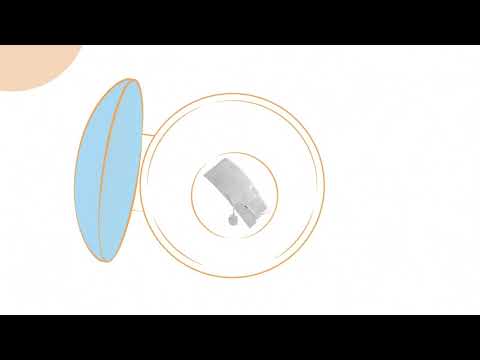 Wellspect | Navina insert instructievideo