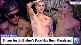 Singer Justin Bieber’s Face Has Been Paralysed