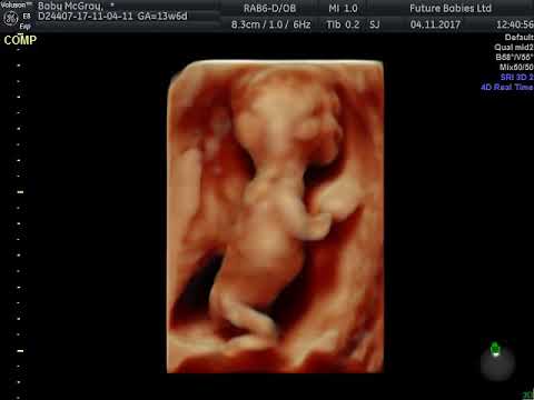 3D / 4D scan at 16 weeks