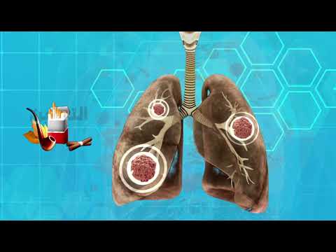 Motion Graphics — Projet 4