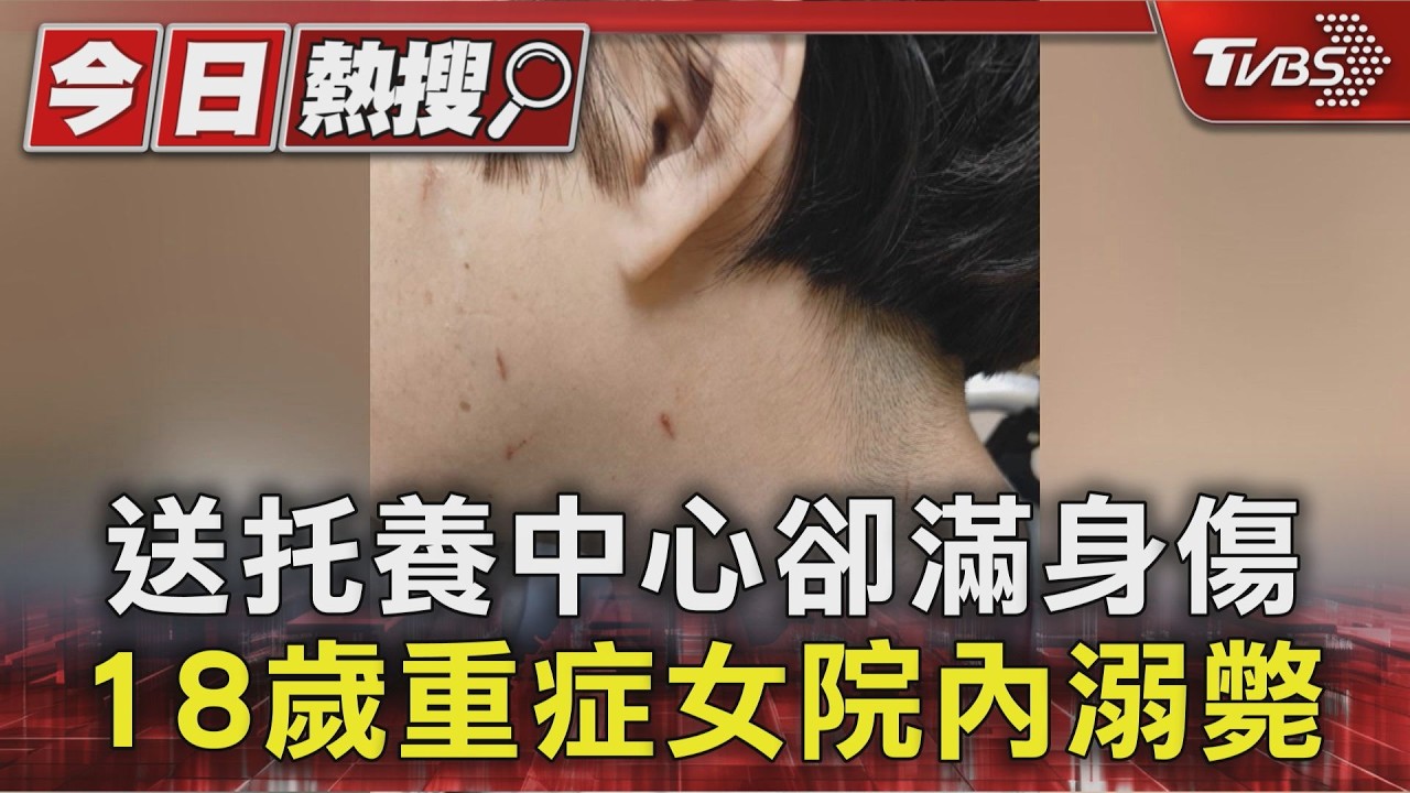 影音／控照顧疏失！　18歲重症女送托養中心滿身傷　盥洗時竟「溺斃」