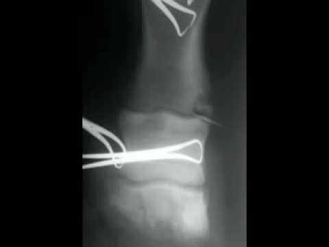 Le articolazioni del cane di spurgo Farmaci per il blocco della artrosi dellarticolazione della spalla
